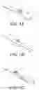 Fig. 02 - ROTARY HANDLE STENT DELIVERY SYSTEM AND METHOD