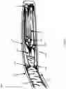 Fig. 02 - Delivery system for endovascular devices