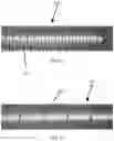 Fig. 06 - Delivery system for endovascular devices