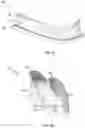 Fig. 08 - CUSTOMIZABLE HEARING PROTECTION DEVICES WITH INTERCHANGEABLE INSERTS AND ACCESSORIES