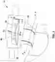 Fig. 02 - Absorbent article with improved fluid containment and comfort