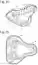 Fig. 08 - STRENGTH-REINFORCED SINGLE USE BEDPAN