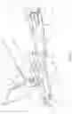 Fig. 02 - Adjustable restraint strap for a limb rest