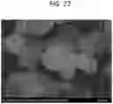 Fig. 28 - INHALABLE DRY POWDER FORMULATIONS COMPRISING ANGIOGENESIS INHIBITORS