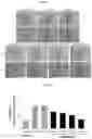 Fig. 04 - PHARMACEUTICAL COMPOSITION FOR TREATING CANCER AND SUPPRESSING METASTASIS, CONTAINING SULFONAMIDE-BASED COMPOUND AS ACTIVE INGREDIENT