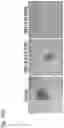 Fig. 584 - Methods for treating plasma cell neoplasm with human therapeutic agents