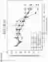 Fig. 98 - Methods for treating plasma cell neoplasm with human therapeutic agents