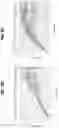 Fig. 06 - EXPANSION OF NATURAL KILLER AND CHIMERIC ANTIGEN RECEPTOR-MODIFIED CELLS