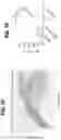Fig. 19 - EXPANSION OF NATURAL KILLER AND CHIMERIC ANTIGEN RECEPTOR-MODIFIED CELLS