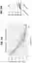 Fig. 54 - EXPANSION OF NATURAL KILLER AND CHIMERIC ANTIGEN RECEPTOR-MODIFIED CELLS