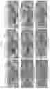 Fig. 20 - BIRTH TISSUE-DERIVED PRODUCTS AND PREPARATION AND USES THEREOF
