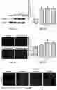 Fig. 02 - Composition and Use of Interleukin Stimulated Human Umbilical Cord Mesenchymal Stem Cells for the Treatment of Rheumatoid Arthritis