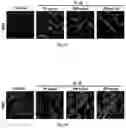 Fig. 06 - Composition and Use of Interleukin Stimulated Human Umbilical Cord Mesenchymal Stem Cells for the Treatment of Rheumatoid Arthritis