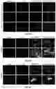 Fig. 08 - Composition and Use of Interleukin Stimulated Human Umbilical Cord Mesenchymal Stem Cells for the Treatment of Rheumatoid Arthritis