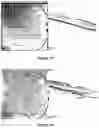 Fig. 02 - Composition of desmodium and trivalent chromium, and ocular use