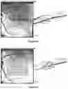 Fig. 03 - Composition of desmodium and trivalent chromium, and ocular use