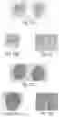 Fig. 18 - Cyclic prosaposin peptides and uses thereof