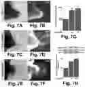 Fig. 08 - Irisin improves placental function during pregnancy