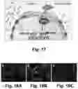 Fig. 18 - Irisin improves placental function during pregnancy