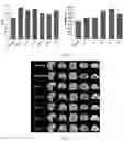 Fig. 05 - Compound composition for improving bone health and preparation and application thereof
