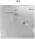 Fig. 05 - Compositions and Methods for Treating Pathological Calcification and Ossification