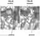 Fig. 18 - Compositions and Methods for Treating Pathological Calcification and Ossification