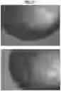 Fig. 23 - Compositions and Methods for Treating Pathological Calcification and Ossification