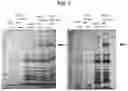 Fig. 08 - VACCINE AGAINST ACINETOBACTER BAUMANNII BASED ON CELLULAR COMPONENTS DEFICIENT IN LIPOPOLYSACCHARIDE