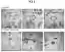 Fig. 10 - VACCINE AGAINST ACINETOBACTER BAUMANNII BASED ON CELLULAR COMPONENTS DEFICIENT IN LIPOPOLYSACCHARIDE