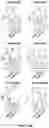 Fig. 32 - Engineered chimeric fusion protein compositions and methods of use thereof