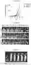 Fig. 03 - MODULATING PERMEABILITY OF THE BLOOD CEREBROSPINAL FLUID BARRIER
