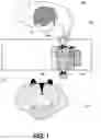 Fig. 02 - Apparatus for currency sterilization and exchange