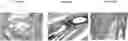 Fig. 01 - Long lasting biodegradable polymer based in-situ forming implant for treatment of bone injuries
