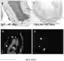 Fig. 04 - COMPOSITIONS AND METHODS FOR GRAFTS MODIFIED WITH A NON-THROMBOGENIC AND PRO-MIGRATORY CELL-DERIVED EXTRACELLULAR MATRIX