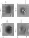 Fig. 06 - A METHOD OF PROVIDING FEATURES ON AN IMPLANTABLE MATERIAL INVOLVING THE USE OF LASER, IMPLANTABLE CARDIOVASCULAR PROSTHESES AND IMPLANTABLE MATERIALS PROCESSED ACCORDING TO SAID METHOD