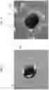 Fig. 08 - A METHOD OF PROVIDING FEATURES ON AN IMPLANTABLE MATERIAL INVOLVING THE USE OF LASER, IMPLANTABLE CARDIOVASCULAR PROSTHESES AND IMPLANTABLE MATERIALS PROCESSED ACCORDING TO SAID METHOD