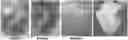 Fig. 01 - Improved Decellularization of Isolated Organs