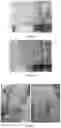 Fig. 06 - Improved Decellularization of Isolated Organs
