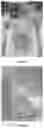 Fig. 07 - Improved Decellularization of Isolated Organs