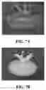Fig. 08 - Improved Decellularization of Isolated Organs