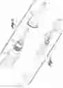 Fig. 02 - INTRAOCULAR IRRIGATOR-ASPIRATOR TIP COMPONENT