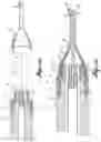 Fig. 11 - INTRAOCULAR IRRIGATOR-ASPIRATOR TIP COMPONENT