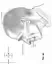 Fig. 09 - Patient interface with movable frame