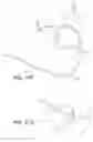 Fig. 37 - Diagnostic catheters, guide catheters, visualization devices and chord manipulation devices, and related kits and methods