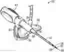 Fig. 01 - Introducer needle having a bump and related systems and methods