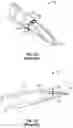 Fig. 02 - Introducer needle having a bump and related systems and methods
