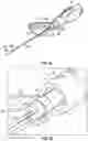 Fig. 07 - Introducer needle having a bump and related systems and methods