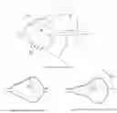 Fig. 02 - Balloon catheter and fluid management system thereof