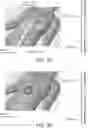 Fig. 09 - DELIVERY OF ELECTROMAGNETIC CHARGE TO MUSCLES