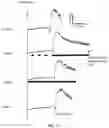 Fig. 12 - Peripheral neuromodulation to treat bladder and bowel dysfunction